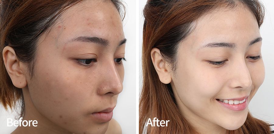 国产品牌老干妈,马应龙老干妈国货走出国门