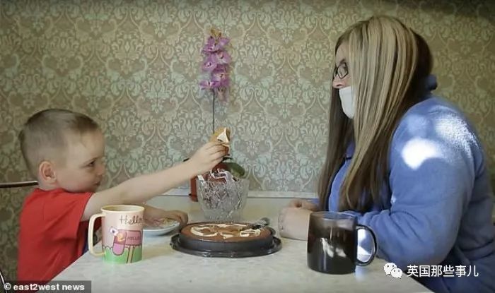 产后长络腮胡,女子生完孩子后长出满脸络腮胡