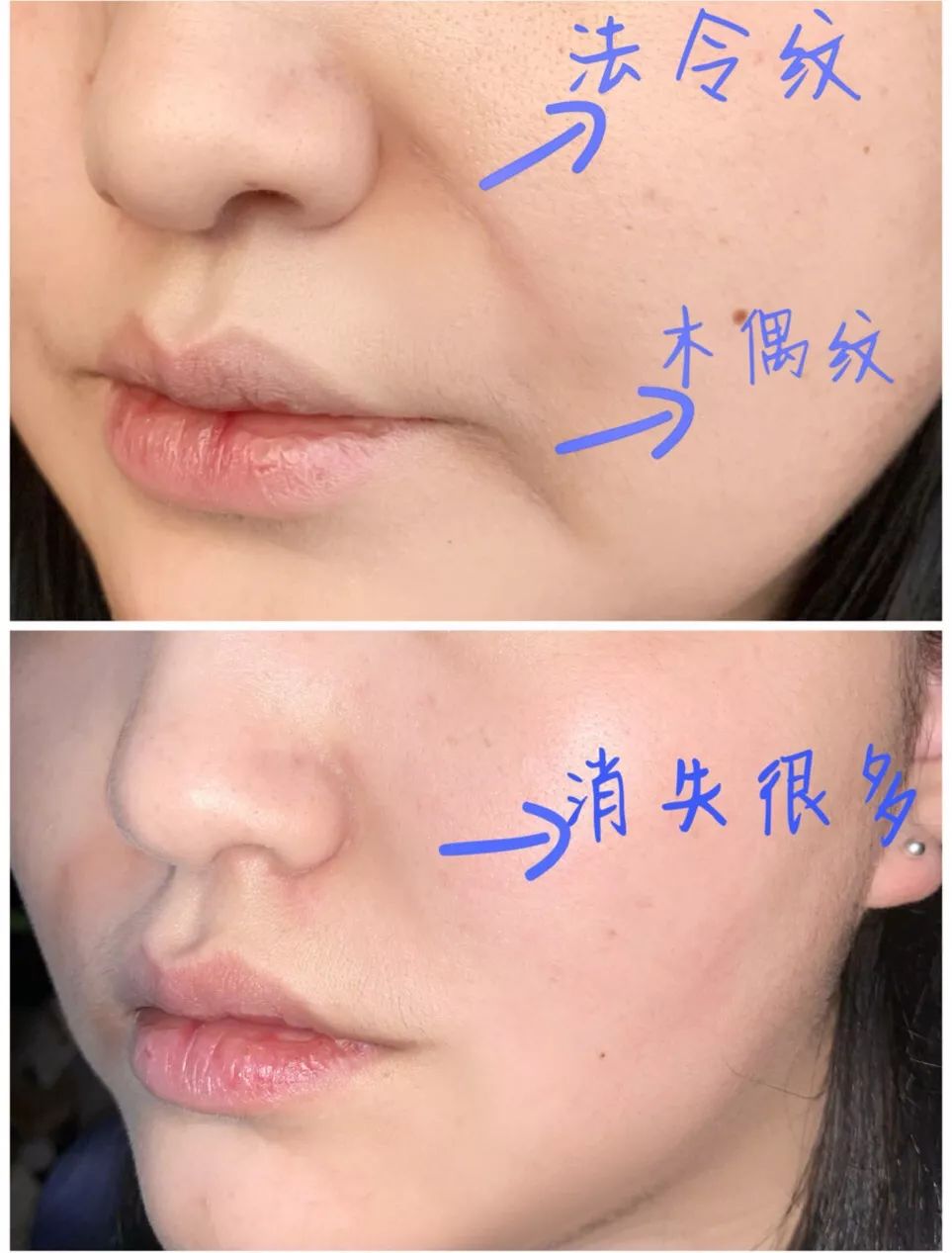 黑科技一秒祛斑,黑科技美白真的有效吗