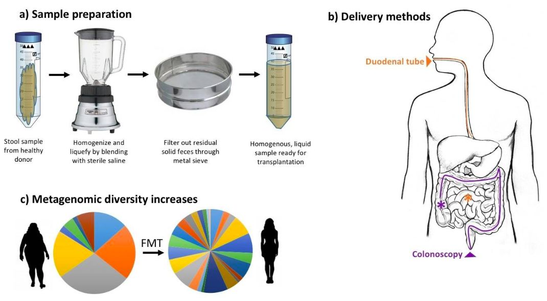 改变胖子的肠道菌群的益生菌,把胖人的肠道菌群移植给瘦人