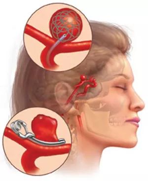 脑子泡在血水里！这种“不定时*弹炸**”很多人都有