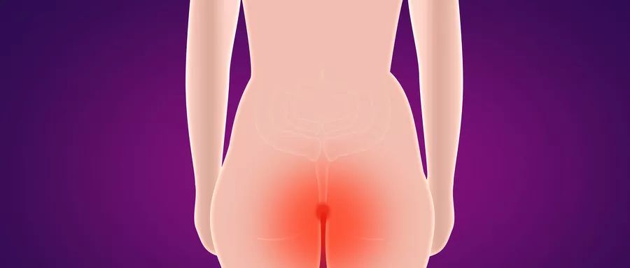 屁股痒肛裂怎么治疗,屁股干裂是肛裂吗