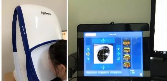 全飞秒手术仅需1.5万元！仅限周末两天，手慢无，速来…