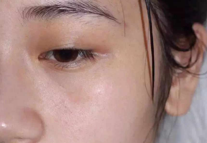 柔嫩抛光|脸上搓出3斤泥!难怪又黄又暗又黑头!10秒给脸蛋“剥壳”,厉害