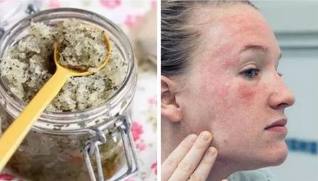 脸上搓出3斤泥！难怪又黄又暗又黑头！10秒给脸蛋“剥壳”，厉害