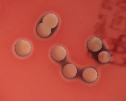 金色葡萄球菌感染会死吗,金色葡萄球菌感染有危险吗