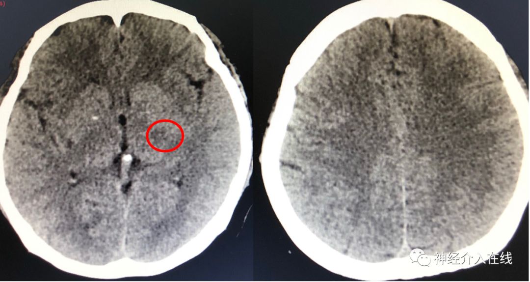 旭日东升第三式,旭日东升第三部