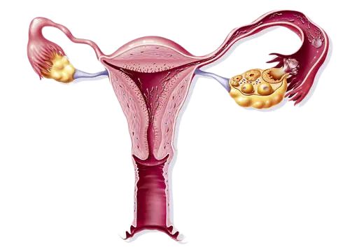 妇产科普|激情过后的腹痛——“黄体破裂”