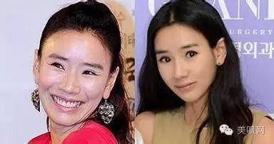韩国整容最漂亮的女明星,韩国整容女明星最多的