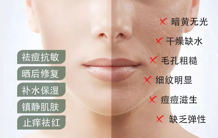 芦荟胶祛痘补水晒后修复,零添加无危害芦荟胶补水推荐