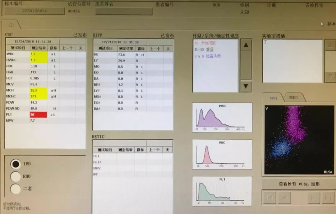 外周血细胞形态分析能查出什么病,外周血细胞形态能看出白血病吗