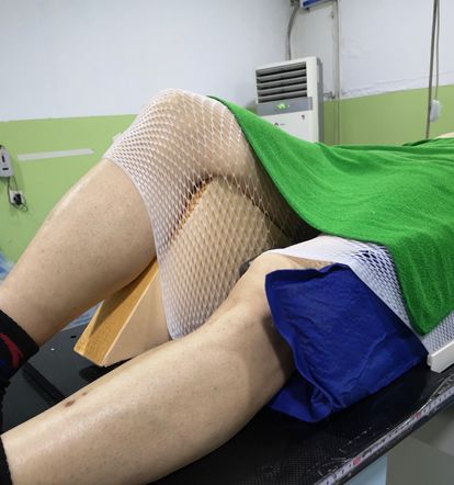 患者初次放疗注意事项,放疗体位固定跟ct模拟需要多久