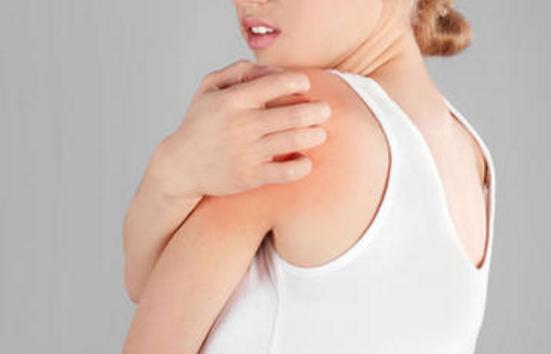 湿疹的防治科普知识,皮肤湿疹一抹它就根治