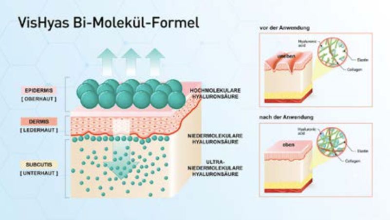 德国balea玻尿酸原液,德国玻尿酸dermaroller安瓶原液