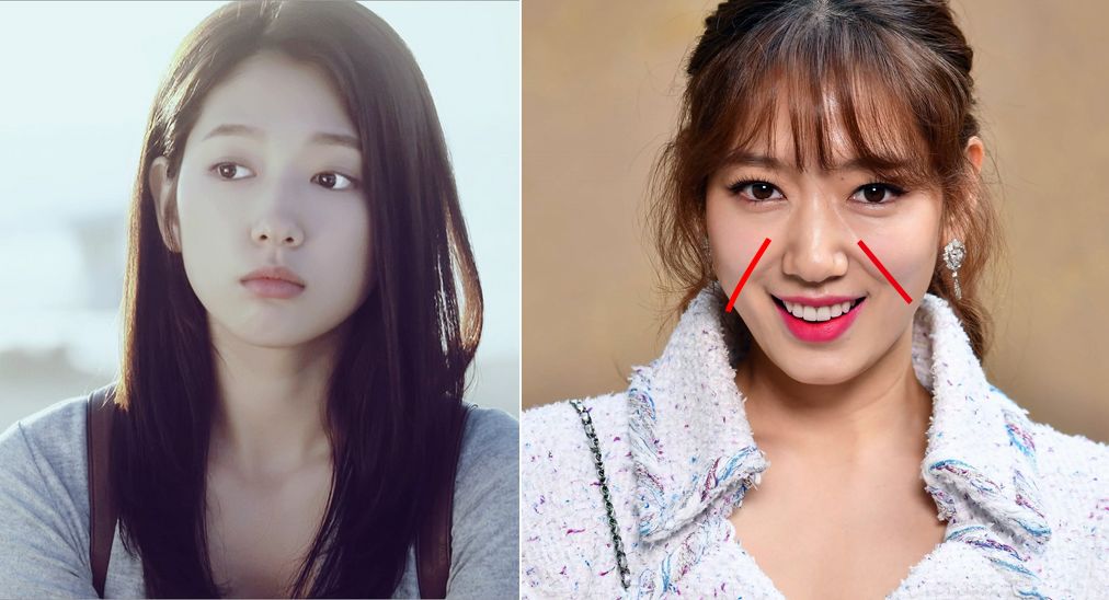 三十岁就有眉间纹法令纹怎么办,30岁法令纹眉心纹深