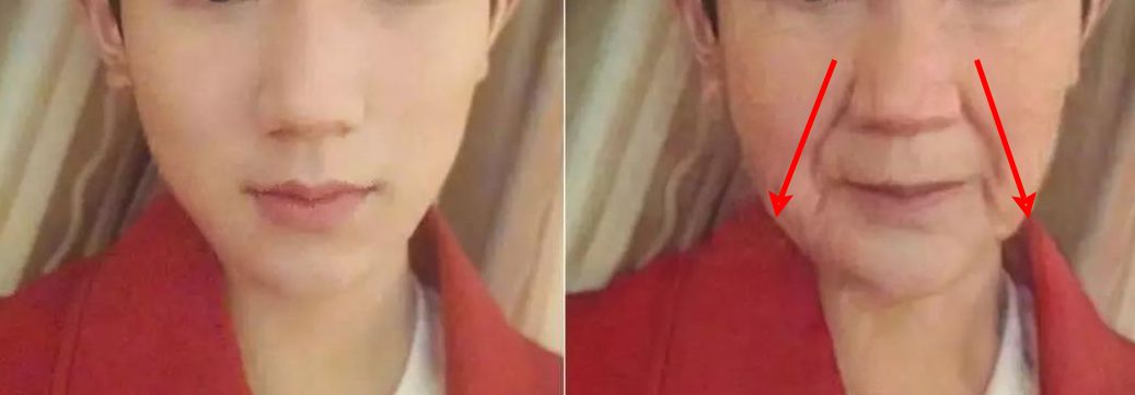 35岁了法令纹鱼尾纹眉间纹怎么办,三十岁就有眉间纹法令纹怎么办