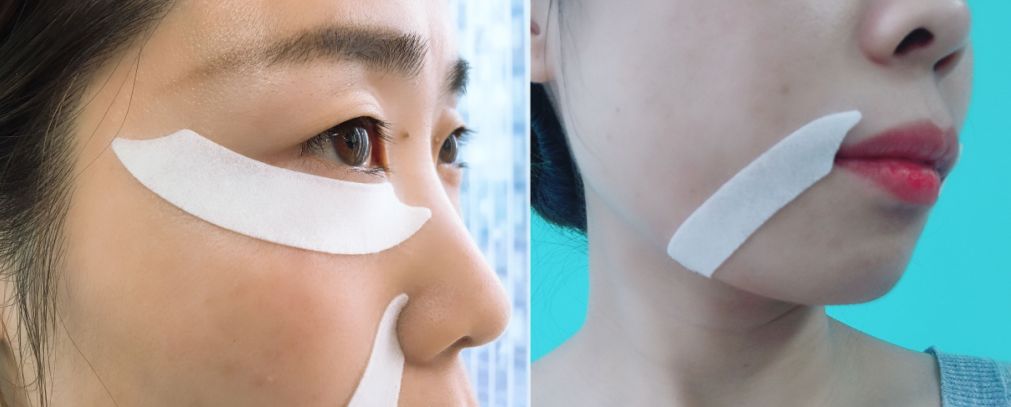 消除眉间法令纹最有效的方法,眉间纹和法令纹医美