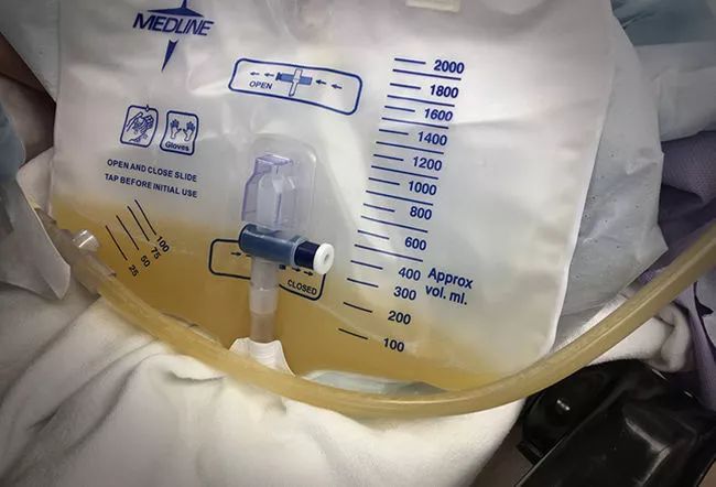 尿液各种颜色都代表什么病,尿液是五颜六色的怎么回事