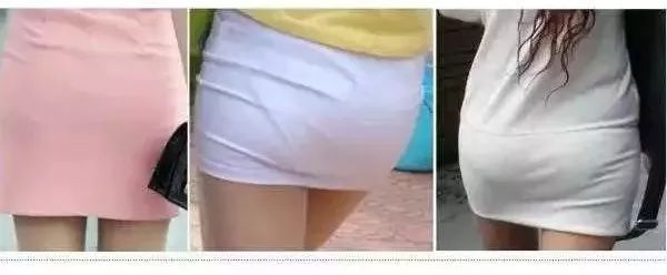 无痕裤为什么无痕,内衣裤处瘙痒小妙招