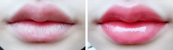 薄唇如何丰唇好看,丰唇使嘴唇变得更美
