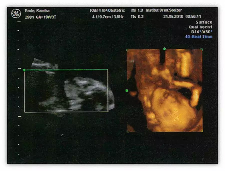 编辑谈小说,编辑一本书需要做什么准备呢