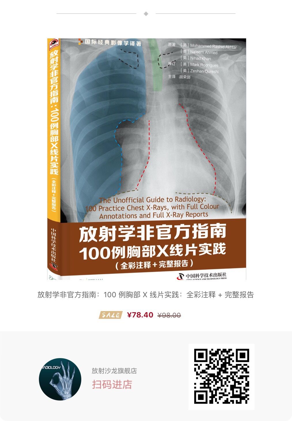 侵袭性纤维瘤影像学表现,侵袭性纤维瘤病影像上易诊断吗