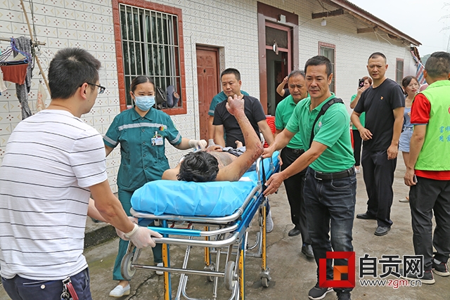 男子重度烧伤100%后续,男子烧伤紧急送医院