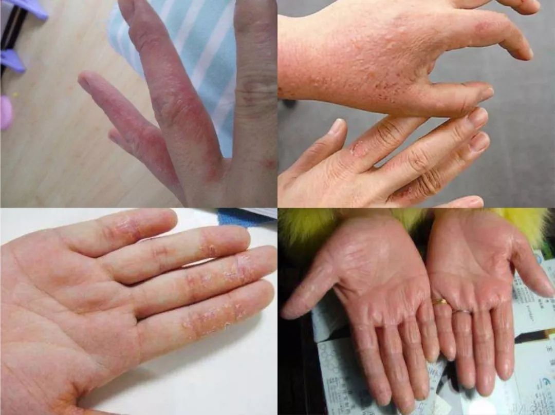 一天洗无数次手，记得要这么做