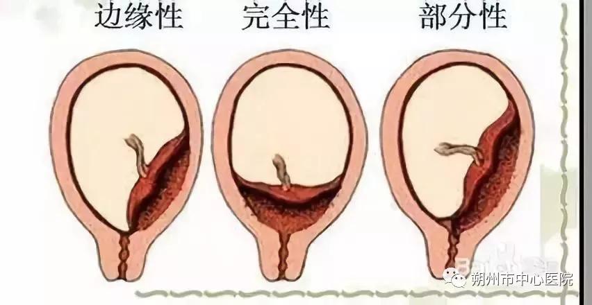 哪些妇科疾病需要进行手术治疗,微创介入治疗妇科疾病