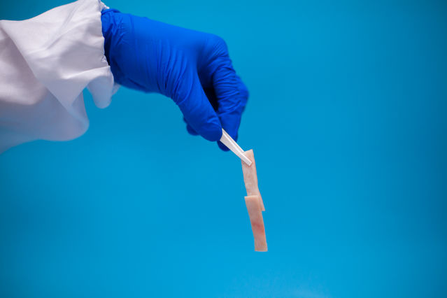 伤口愈合胶水,神奇胶水