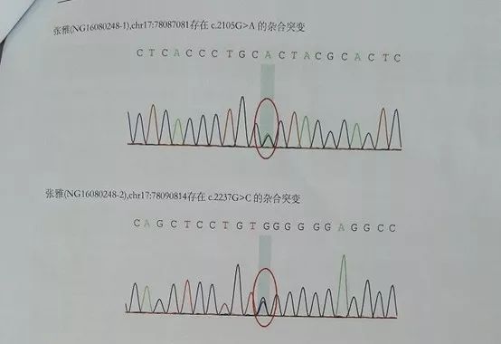 肝功能异常病例,肝功能异常10大病因
