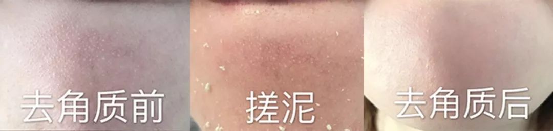 去黑头角质平价水乳,去黑头日本洗面奶
