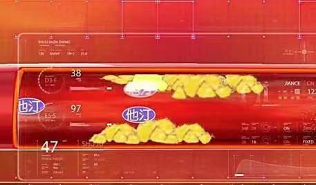 出现这4个征兆可能是血管堵住了,三根血管严重堵塞危险吗