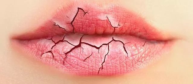 嘴唇干裂脱皮用什么润唇膏好,嘴巴一直脱皮干裂可以用润唇膏吗