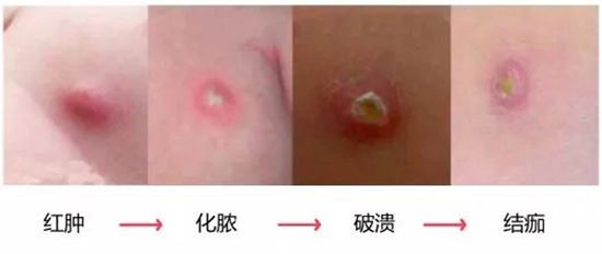 这个是啥？我父母、爷爷都有，为啥我没有？