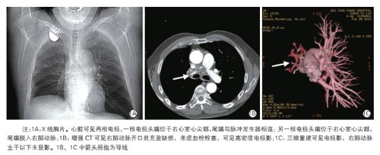 阜外医院心内科华伟,阜外心内科华伟