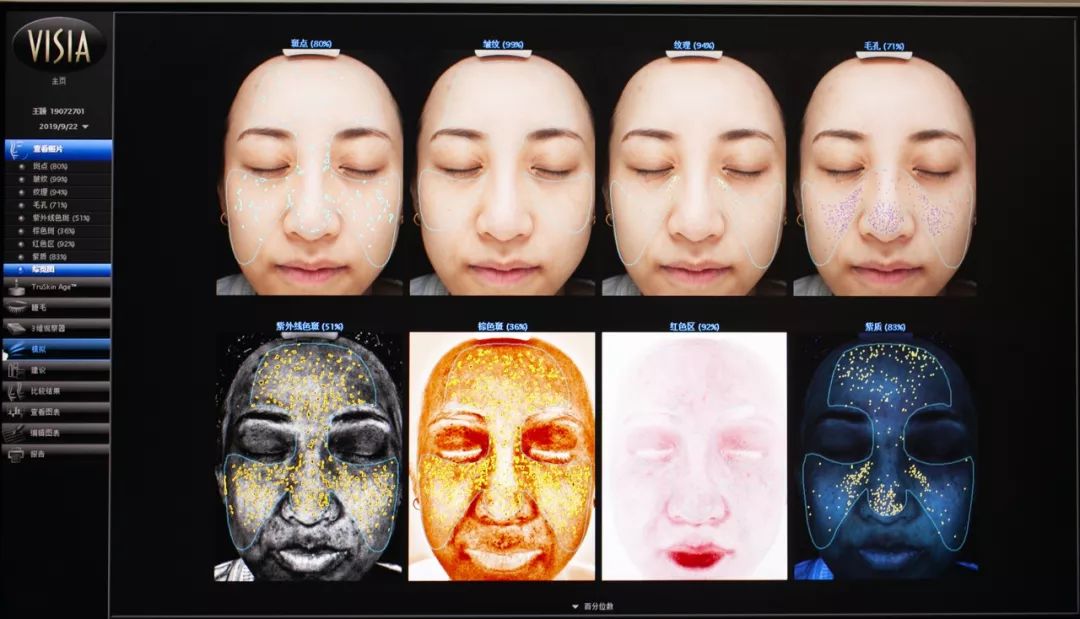 肌诊室修复,肌诊室水光肌挑战