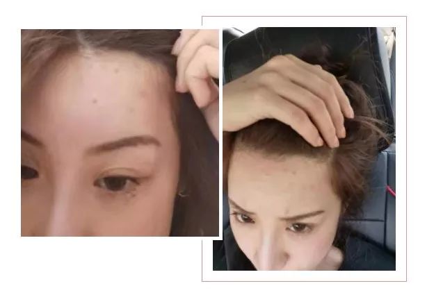 肌诊室·特别版|真人体验，医美素颜光vs明星微精华，改善皮肤哪家强？