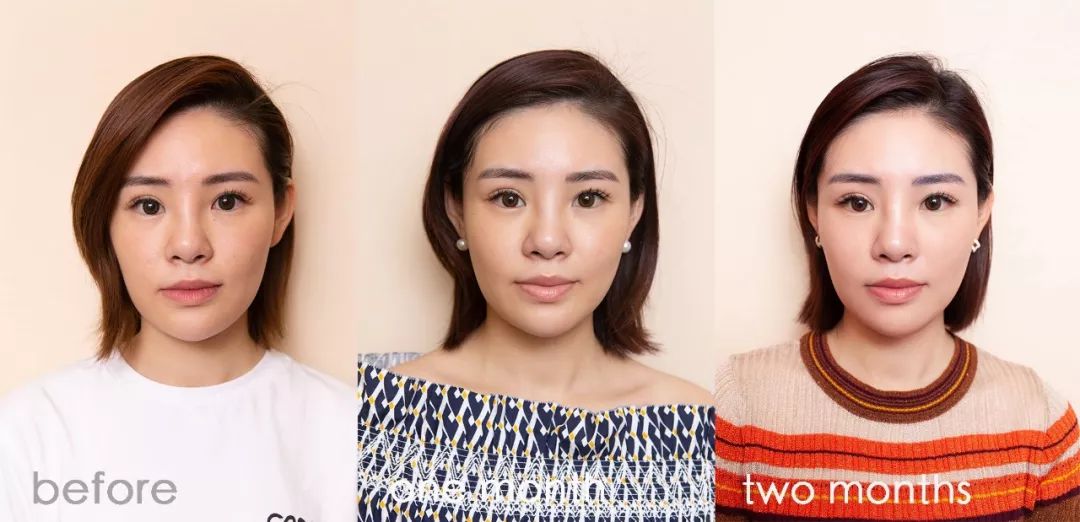 肌诊室·特别版|真人体验，医美素颜光vs明星微精华，改善皮肤哪家强？