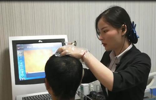 脱发人群趋势,阿里健康报告脱发