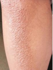 好书推荐｜《皮肤病彩*图色**谱》（第4版）