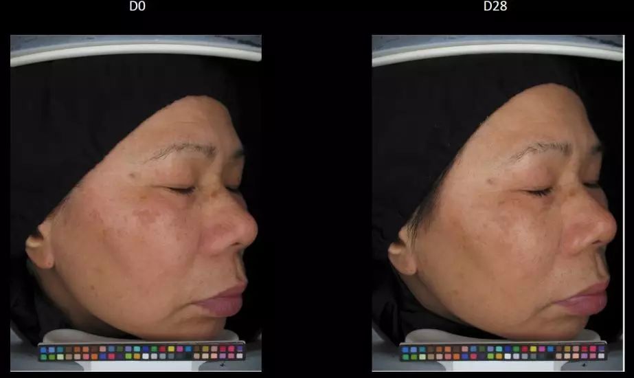 真正变白变美的方式竟然是这样,5个变白小技巧