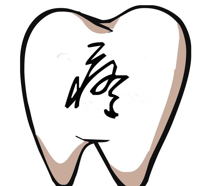 牙痛吃啥药最快最有效,牙痛吃什么药最快见效