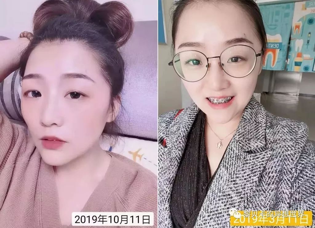 最短只要一年，这件事做对了堪比整容