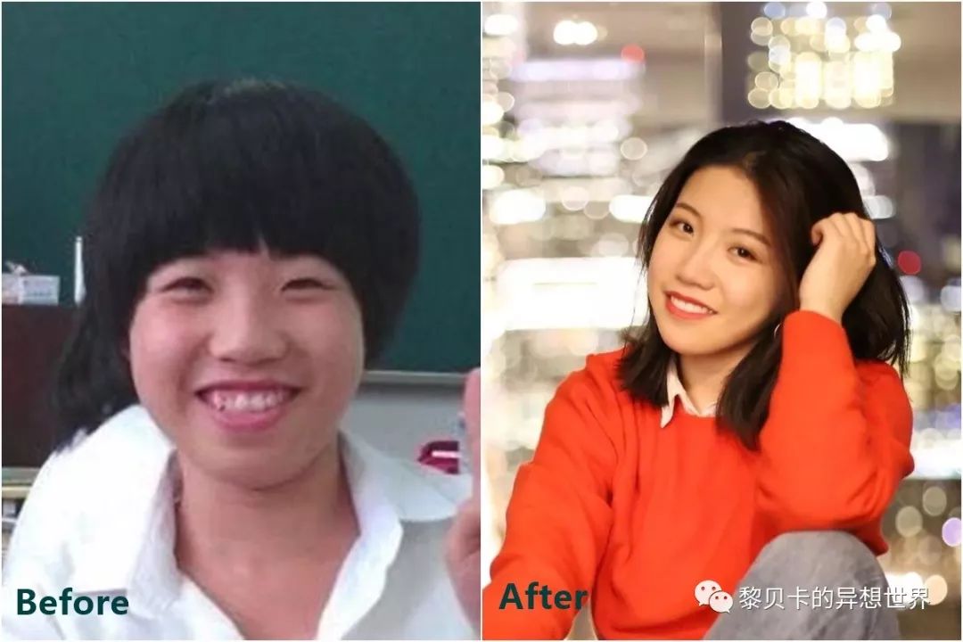 最短只要一年，这件事做对了堪比整容