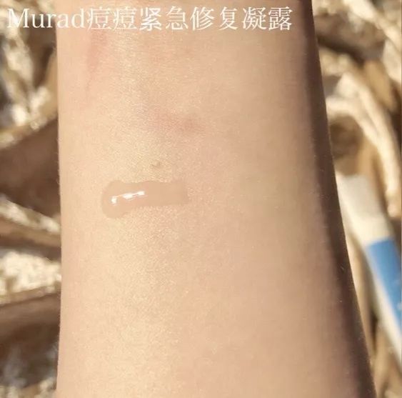 战痘总结,战痘十年是什么样子