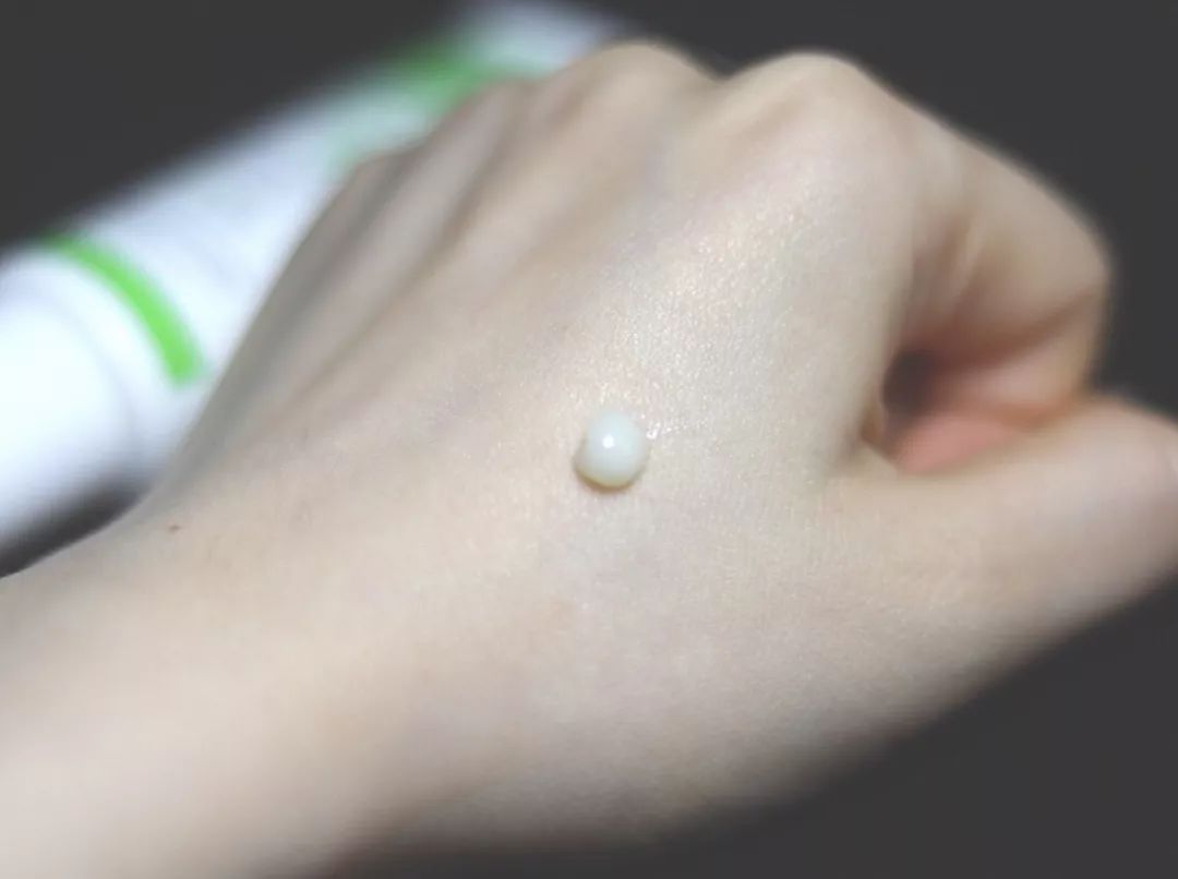 战痘总结,战痘十年是什么样子