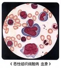 全血细胞减少疾病，你还傻傻分不清？
