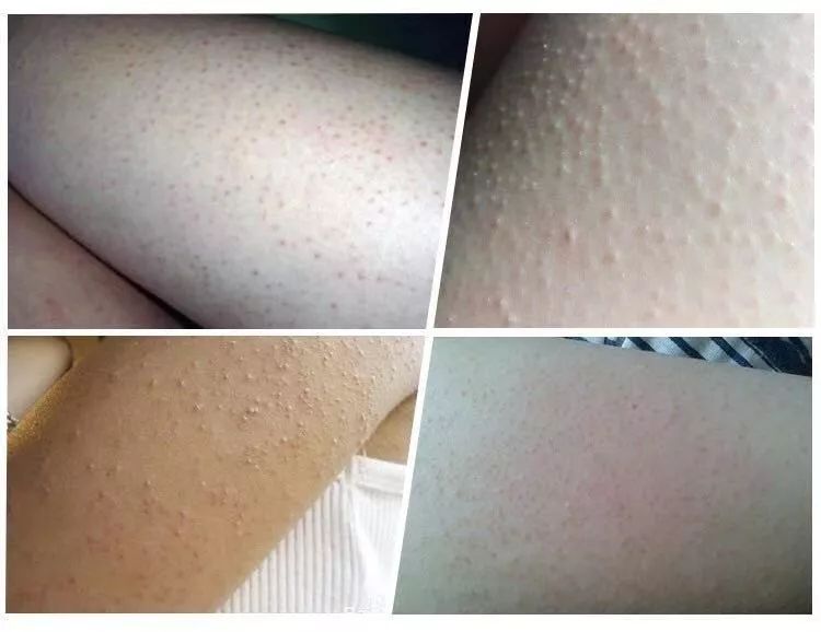 1滴绵羊油≈1次羊奶浴，来自澳洲绵羊油身体乳让你爱上摸自己