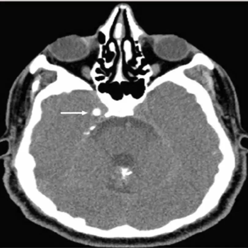 神经影像,神经影像解剖图